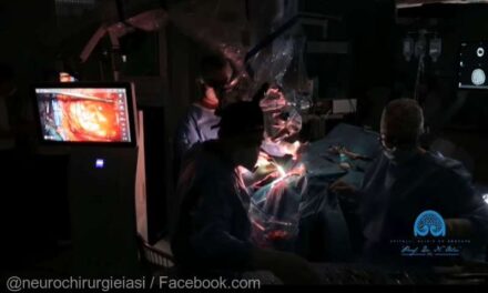 Medicii de la Spitalul de Neurochirurgie din Iași au extirpat o tumoră cerebrală de 10 centimetri unei femei din Botoşani