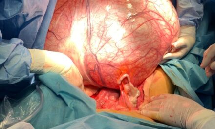 Tumoră de 40 kg, extirpată de medicii de la Spitalul Universitar de Urgenţă Militar Central