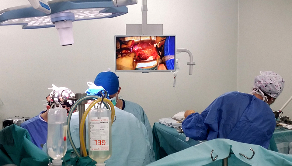 Procedură complexă hibridă de endoprotezare a aortei toracice rupte, în  premieră naţională, la IUBCvT Târgu Mureş
