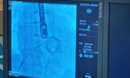 Premieră pentru chirurgia cardiovasculară din Transilvania: o echipă medicală din Sibiu a realizat o intervenție transcateter complexă de implantare a unei valve Sapien3 într-o proteză biologică mitrală degenerată
