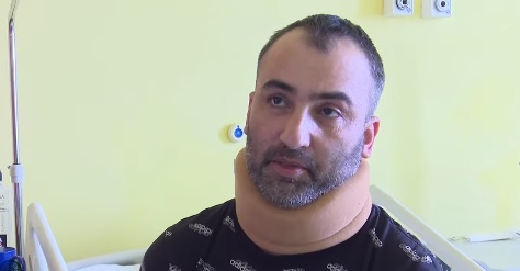 Medicii de la Spitalul de Neurochirurgie din Iași au extirpat o tumoră rar întâlnită