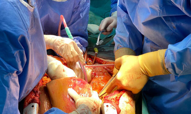 Transplanturi renale şi hepatice, efectuate la spitalele ieșene Parhon și Sf. Spiridon de la un donator aflat în moarte cerebrală