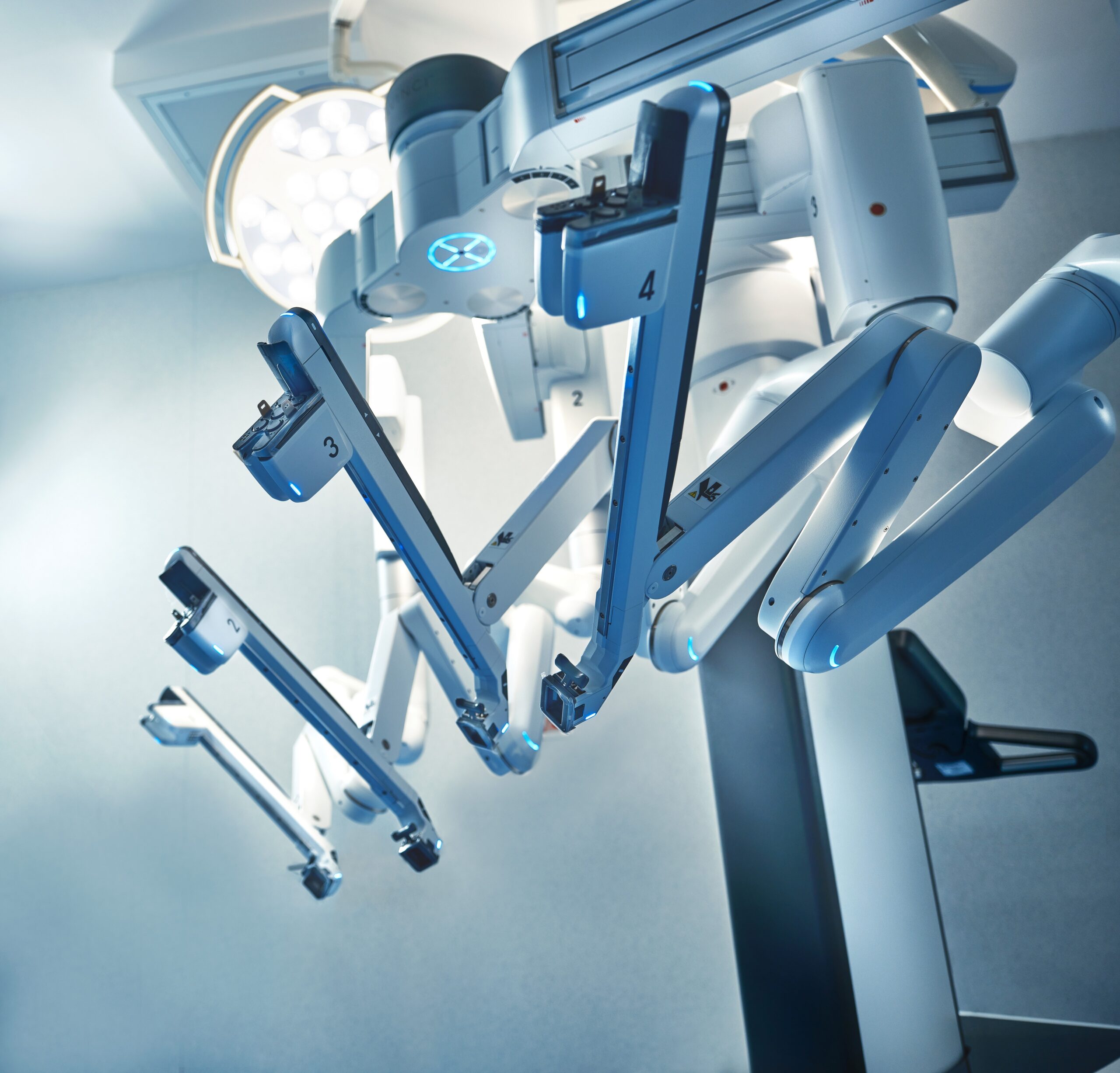 Premieră în chirurgia robotică – O pacientă cu hernie incizională complexă a fost operată robotic prin cea mai modernă tehnică de reconstrucție a peretelui abdominal